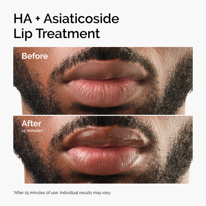 HA + Asiaticoside Lip Treatment